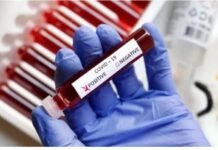 Coronavirus is returning again! Cases are increasing rapidly in these countries
